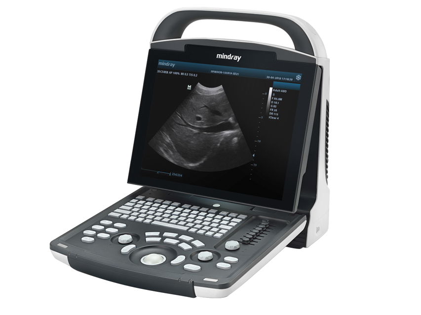 MINDRAY 2D ULTRASOUND(dp-10)(with one probe inclusive)